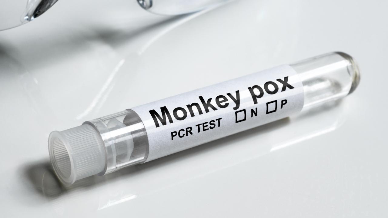 Montreal Public Health Alerts Residents to New Mpox Cases