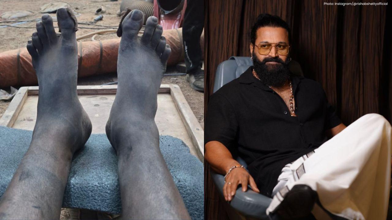 Rishab Shetty Films Kantara Climax Despite Swollen Leg, Inspires Fans
