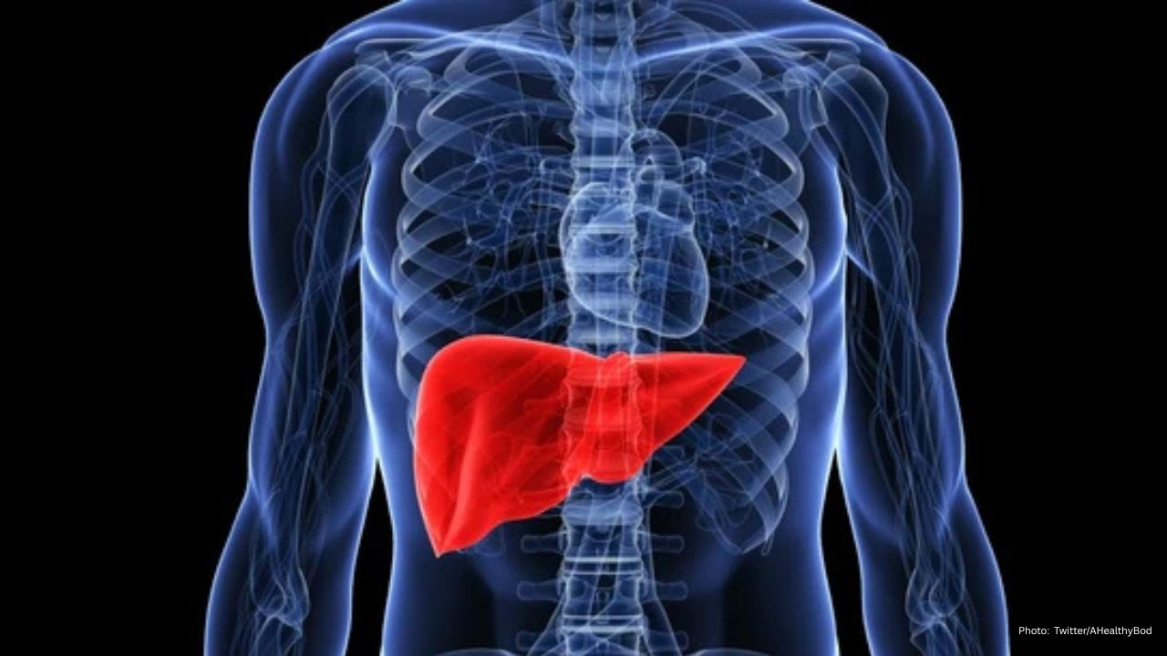 Delhi Doctor’s Friendly Guide: Spotting Fatty Liver Through Simple Physical Signs