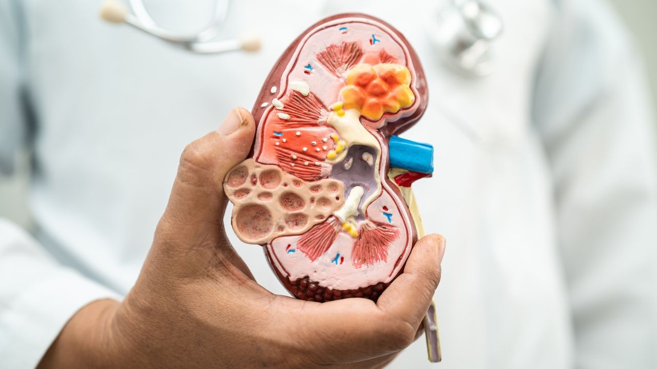 Surge of Chronic Kidney Disease Cases Noted in India for 2023
