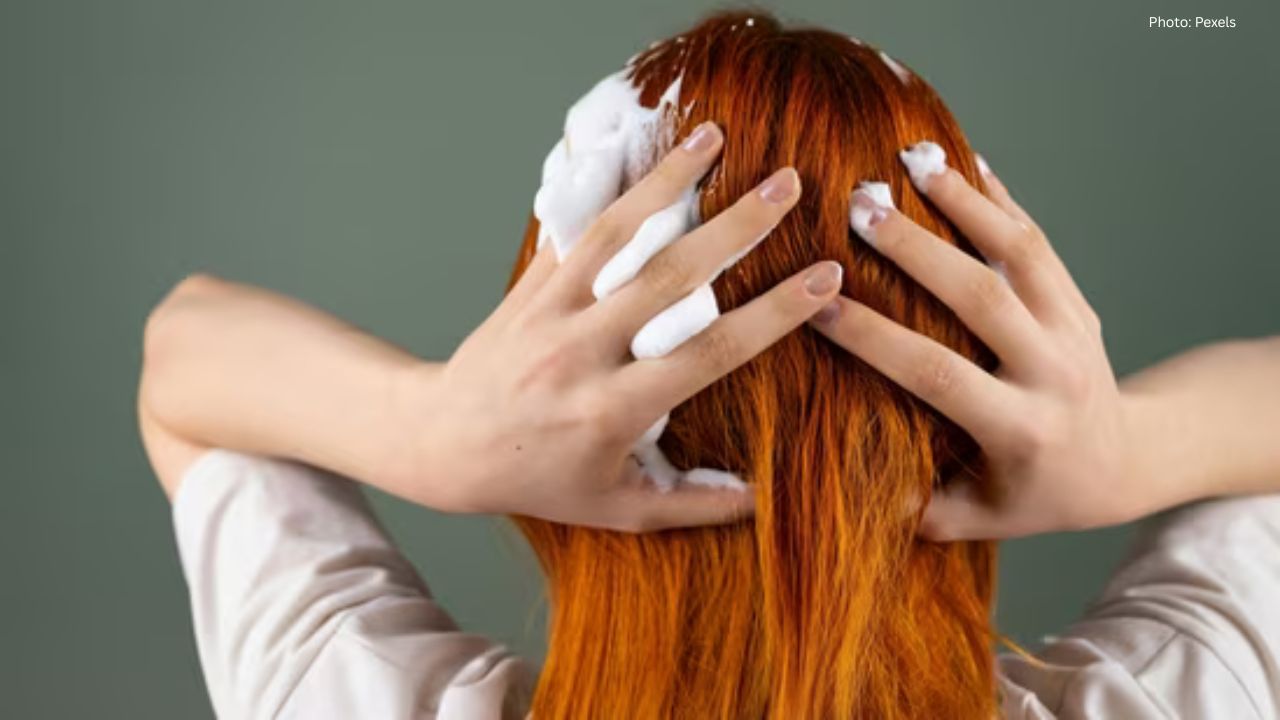 Top 8 Anti-Dandruff Shampoos for a Healthy Scalp
