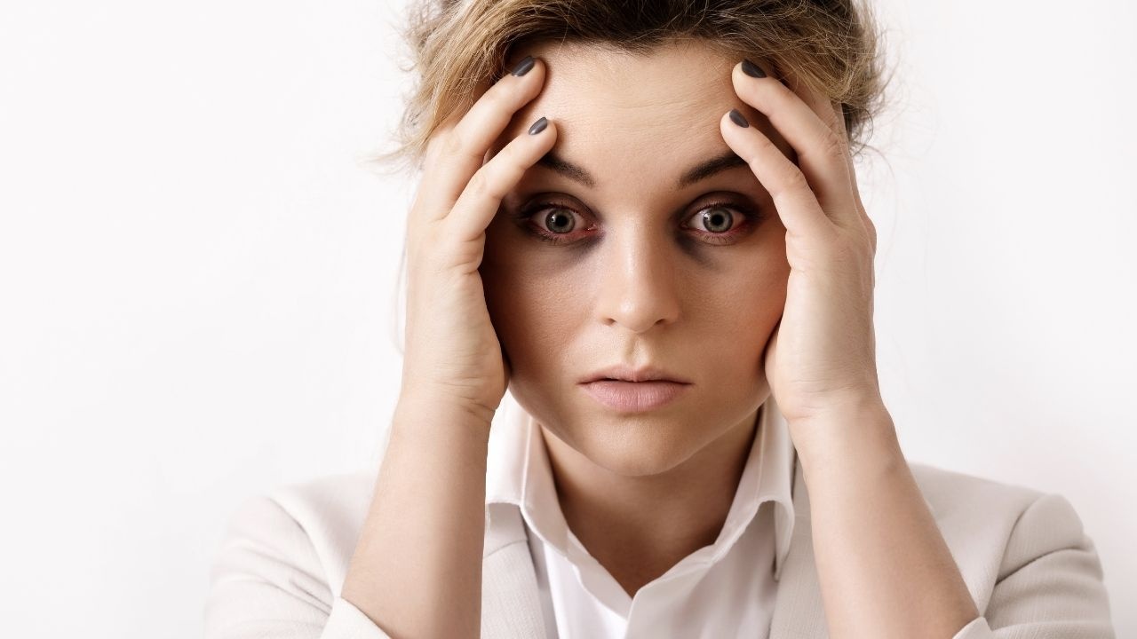 Bright Eyes Ahead: 10 Kitchen Remedies to Eliminate Dark Circles