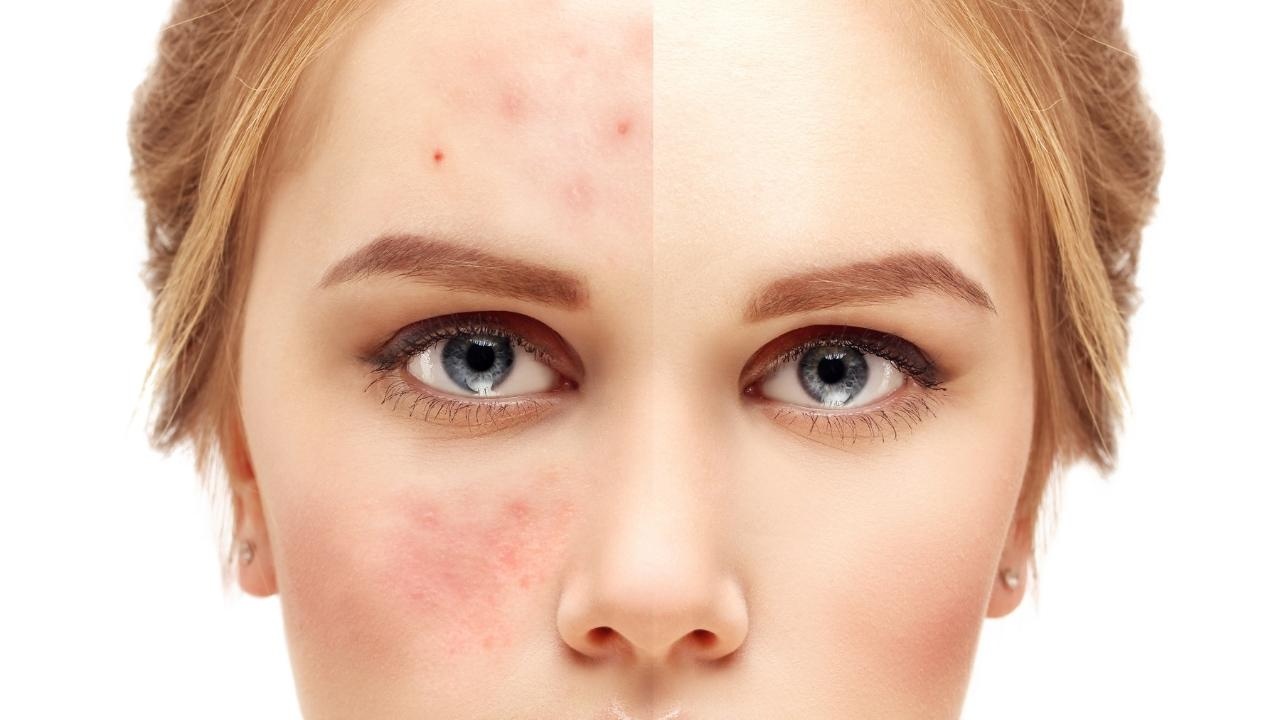 Revitalize Your Skin: A 3-Step Guide to Healing Your Skin Barrier