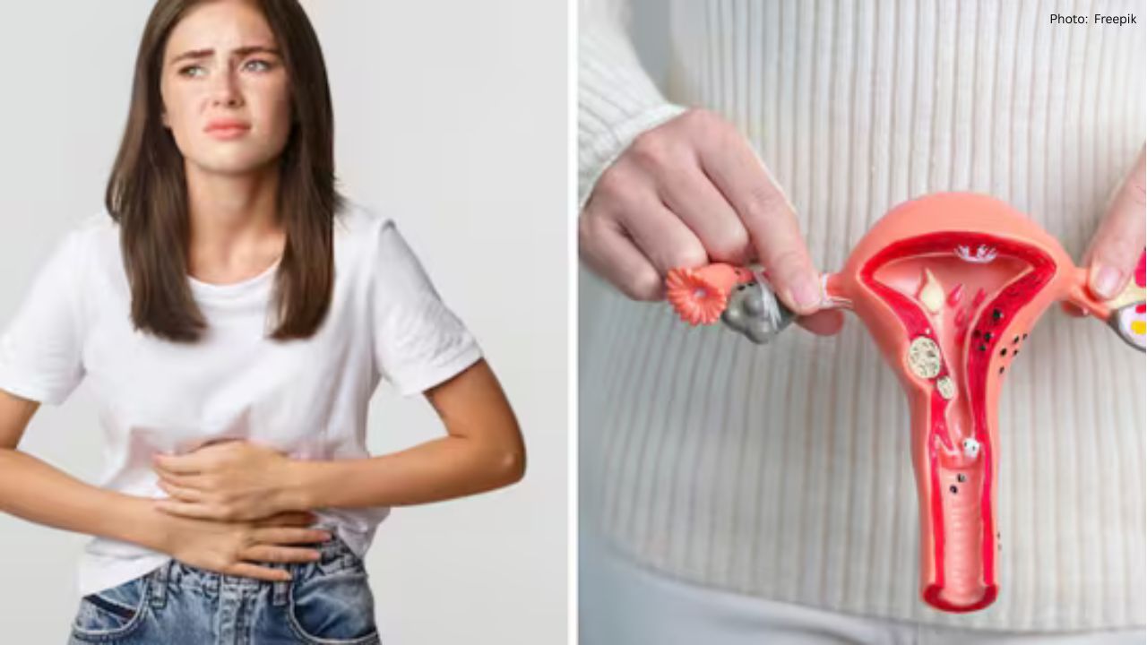 30-Year-Old Woman Discovers Significant Silent Fibroids During Routine Health Check