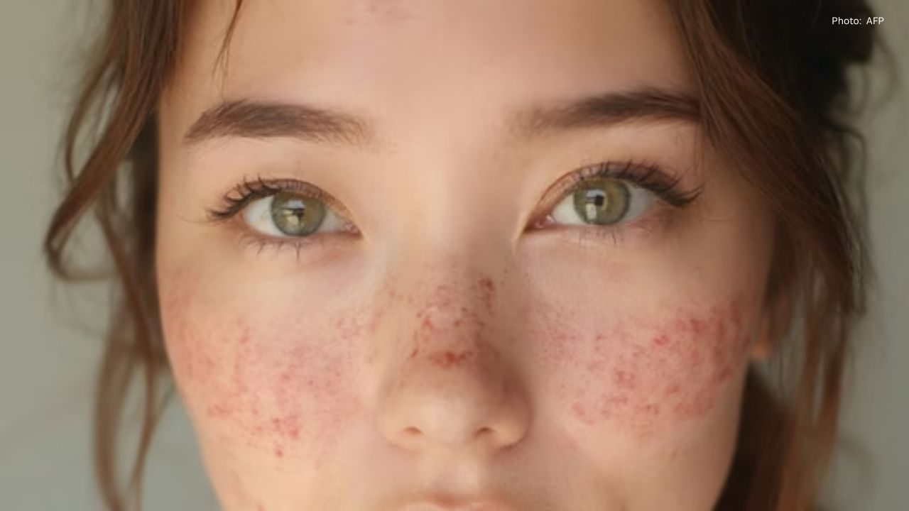 Ultimate Guide to Selecting the Perfect Winter Moisturizer for Healthy Skin