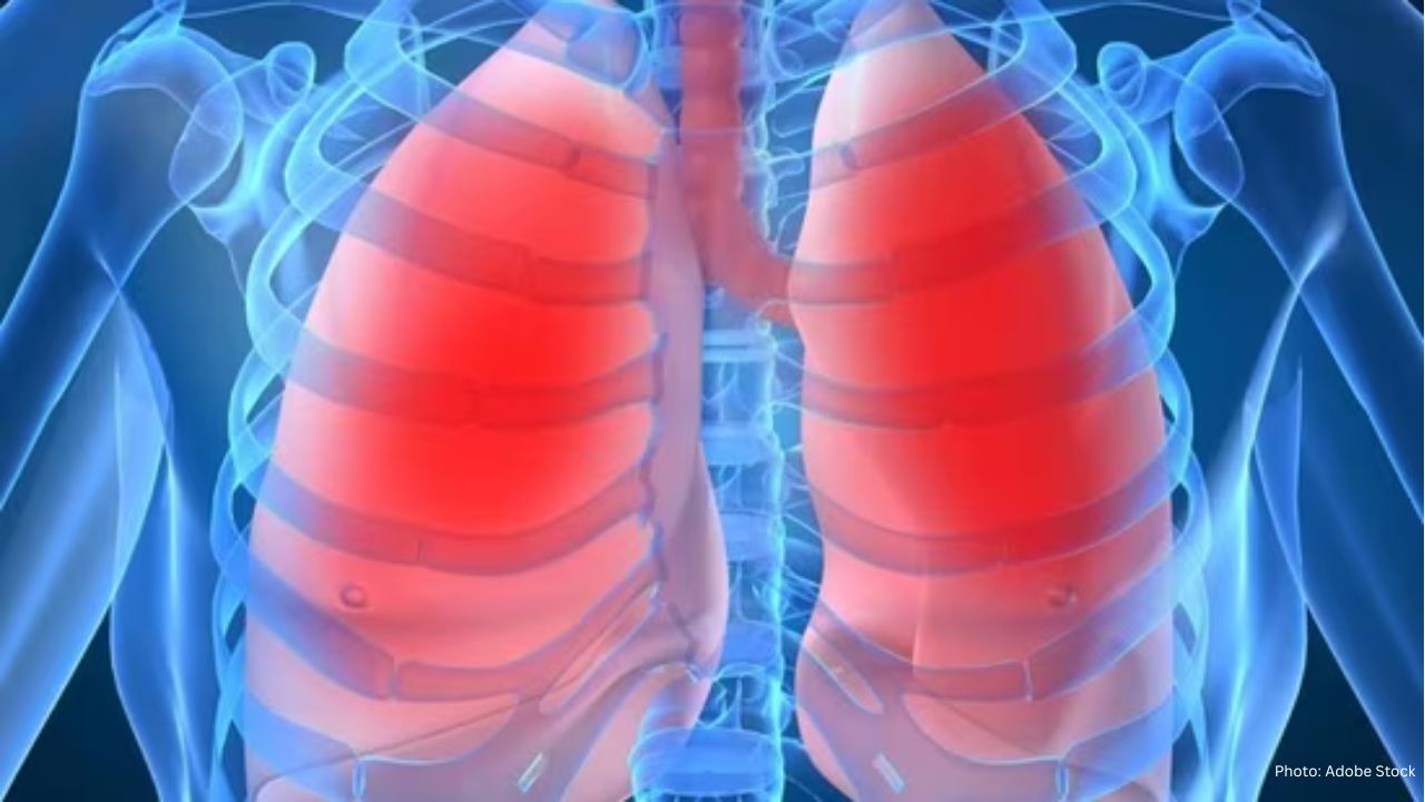 Myths About COPD: A Lung Specialist’s Insights Amid Rising Risks