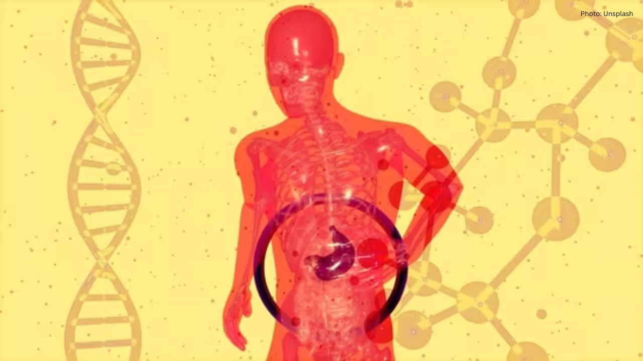 Rapid Rise of Silent Liver Disease MASLD Across America