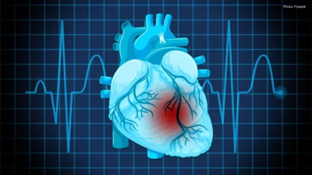 The Perils of Postponing Chest Pain Treatment: Insights from a Manipal Hospital Cardiologist