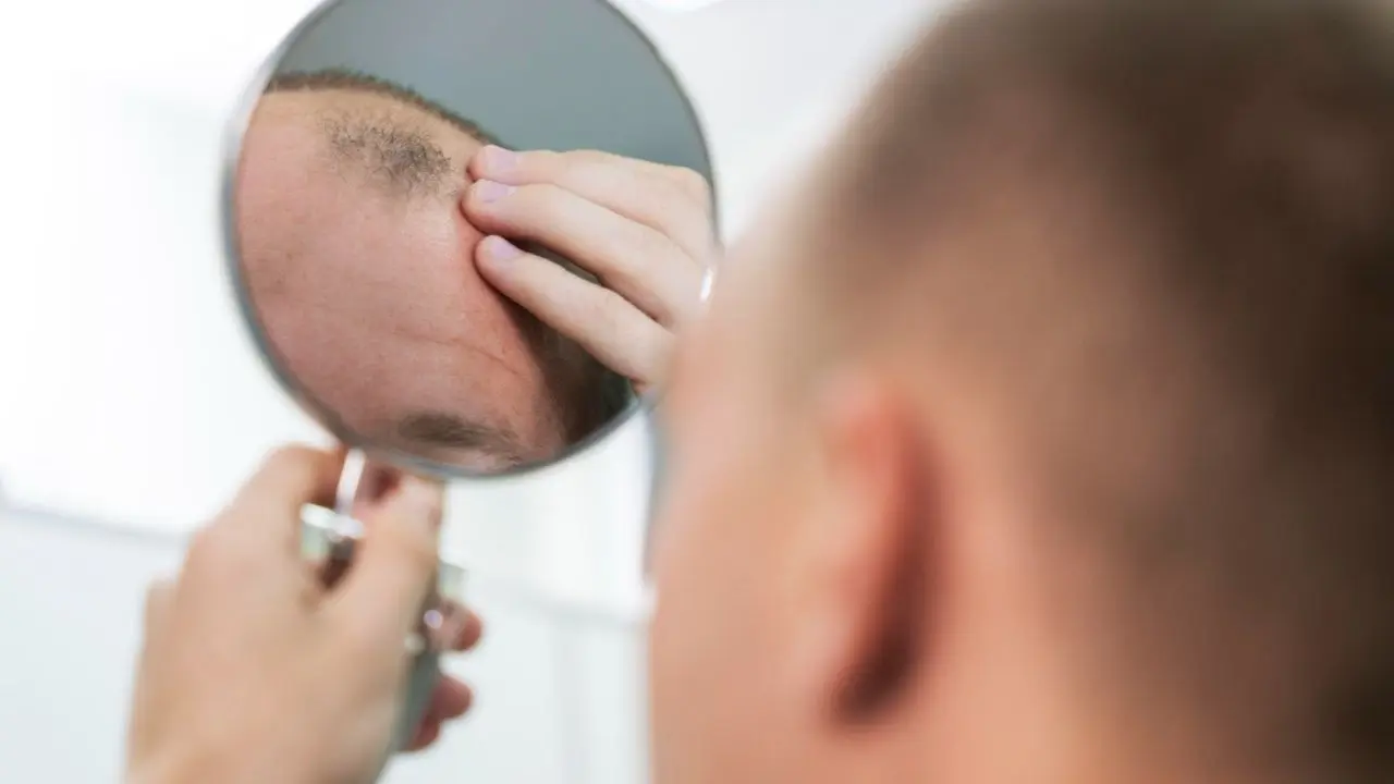 5 Essential Oils for Rejuvenating Bald Spots