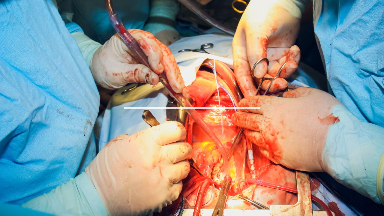 Kelowna Woman’s Long Wait for Liver Transplant Highlights System Strain