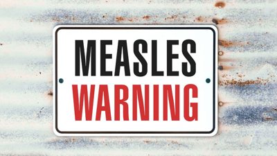 Manitoba Health Warns of Measles Exposure at Brandon Ag Days Event