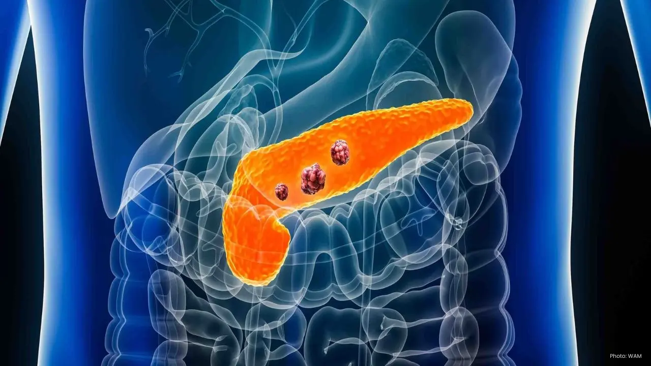 Revolutionary Daily Pill Offers Hope for Pancreatic Cancer Patients