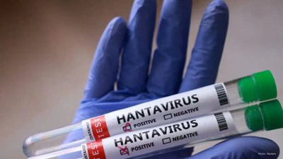 Hantavirus Has No Cure  Here's Where Researchers Are At With Treatments And Vaccines